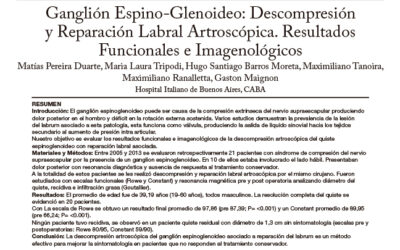 Ganglión Espino-Glenoideo:  Descompresión y Reparación Labral Artroscópica.  Resultados Funcionales e Imagenológicos – Dr. M. Ranalletta